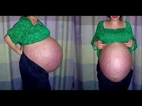 5 გასაოცარი და შოკის მომგვრელი ფაქტი, ფეხმძიმე ქალებზე და მშობიარობაზე